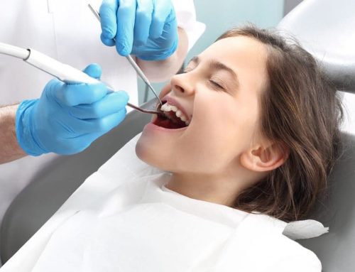 4 things you need to know about Dental Implants